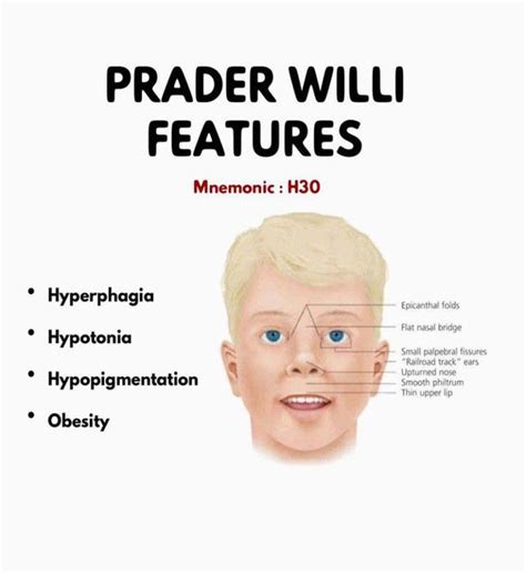 willy prada|prader willi syndrome symptoms nhs.